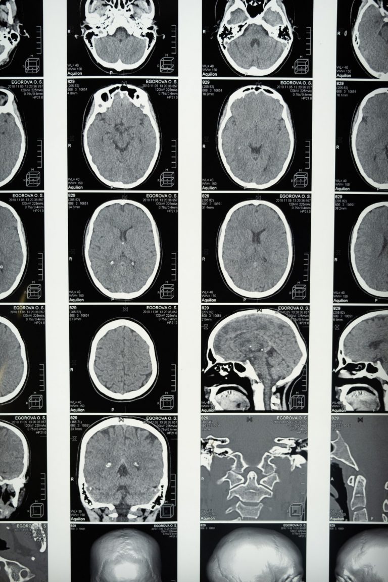 medical imaging of the brain